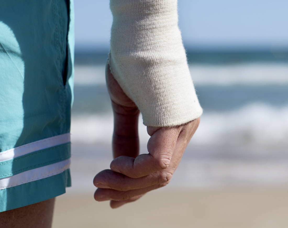 Mann in Shorts mit Verband am rechten Handgelenk am Strand